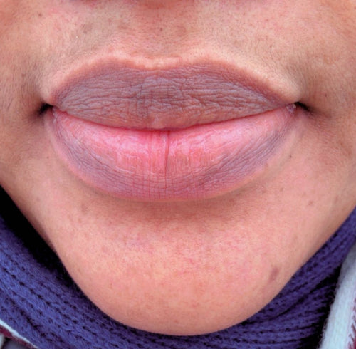 Baume à lèvre rose