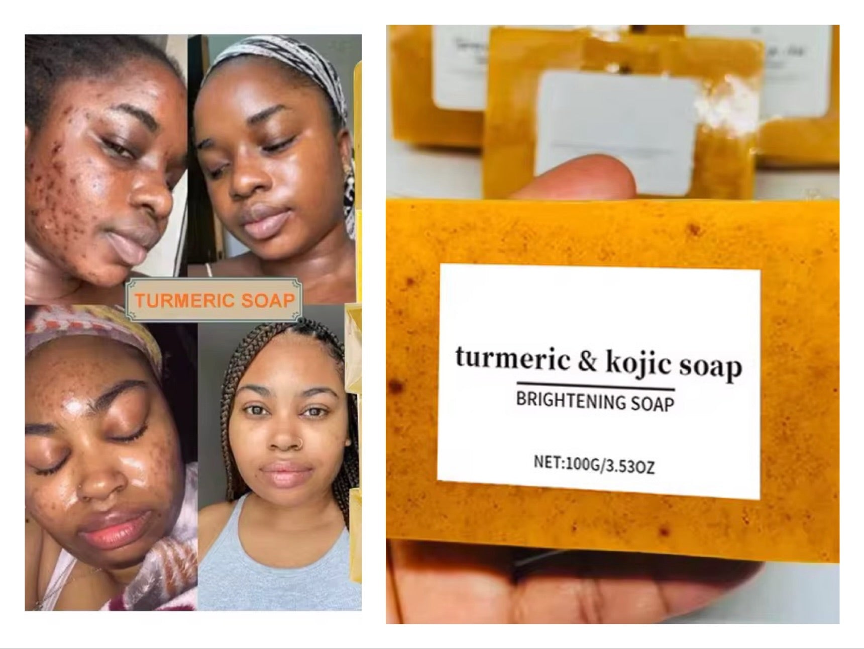 Tumeric Acid Kojic 6 pièces